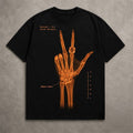 NY Knicks Jalen Brunson Surgery X-Ray Shirt 2026 Jalen Brunson Merch Best Gift For Him