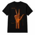 Jalen Brunson Wrist Surgery X-Ray Shirt 2026 NY Knicks Jalen Brunson Merch Basketball Fan Gifts - Loomnari