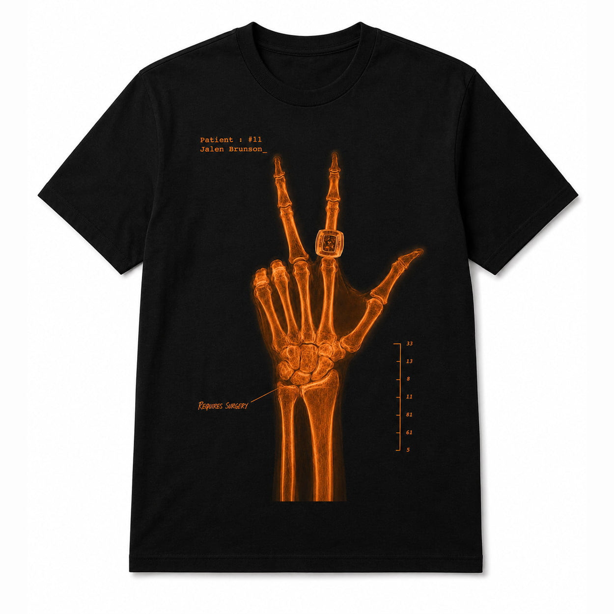Jalen Brunson Wrist Surgery X-Ray Shirt 2026 NY Knicks Jalen Brunson Merch Basketball Fan Gifts - Loomnari